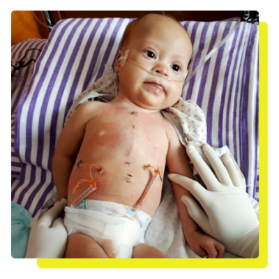 rowans-undergoing-treatment-Rowan's-down-syndrome-awareness-centre-hoima-uganda-east-africa undergoing-treatment-Rowan's-down-syndrome-awareness-centre-hoima-uganda-east-africa